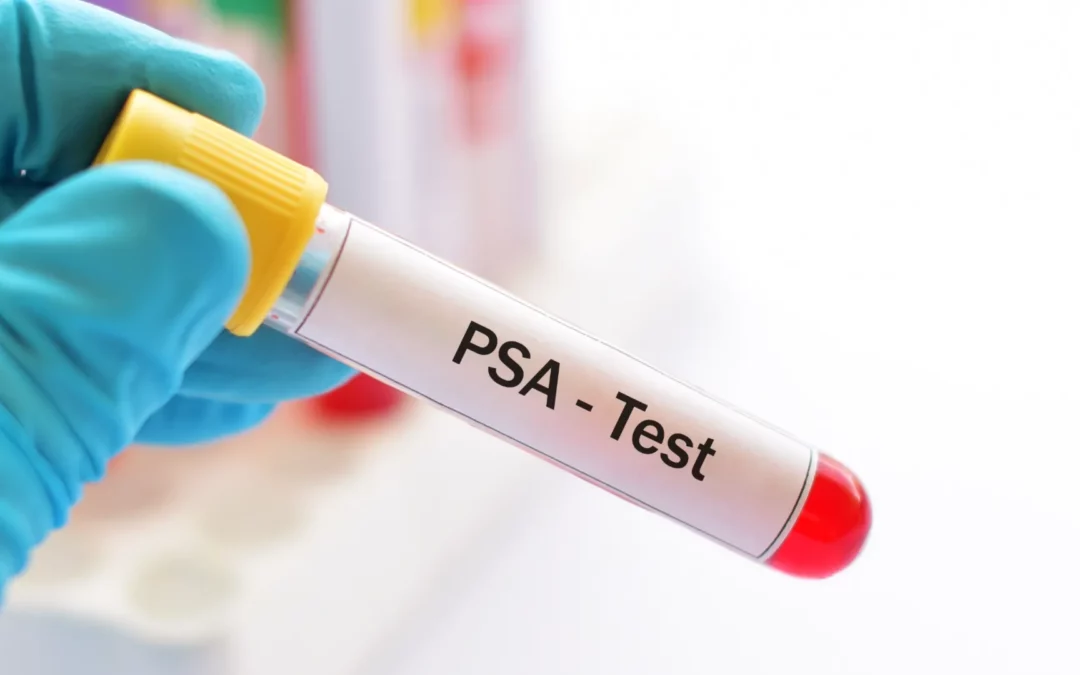 PSA-Test neuer Standard in Prostatakrebs-Leitlinie