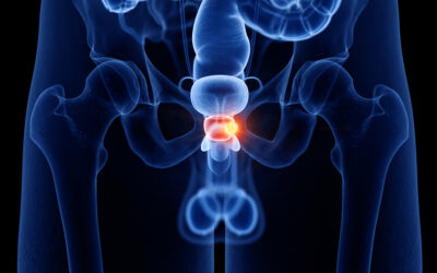 Aktuelle Entwicklungen und Fortschritte in der Prostatakrebsbehandlung: Ein Überblick der neuesten Therapien und Diagnosemethoden