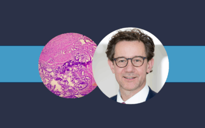 Prof. Dr. Sven Perner über die Rolle der Pathologie bei Prostatakrebs
